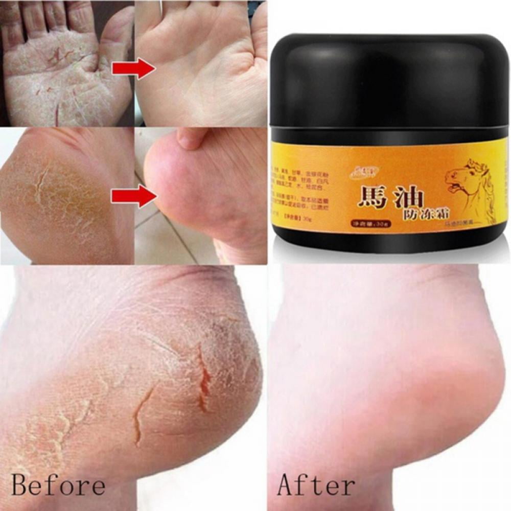 Monfince Foot Cream Horse Oil ,Best Callus Remover for Feet, Knees& Elbows,Natural Moisturizes Nourishes Softens Dry, Rough, Cracked, Dead Skin , 30g
