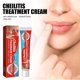 thumbnail image 2 of Bálsamo labial CHAO 20 g tratamiento de queilitis, 2 of 5