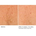 thumbnail image 6 of Deco-Lift Neck  Decollete Firming  Lifting Complex 1.7 oz, 6 of 8