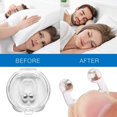 thumbnail image 5 of ShenMo Anti Snoring Device, Snoring Solution, Silicone Magnetic Anti Snoring Nose Clip, Professional Comfort Relief Snoring Sleep Sleep Aid 4 Pack White, 5 of 5