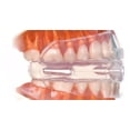 thumbnail image 3 of Guarda Bucal Inteligente con Amortiguadores de Aire. Cómoda. Se puede usar con Brackets. PARATO2 Inteligente con Amortiguadores de aire., 3 of 4