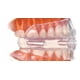 thumbnail image 3 of Guarda Bucal Inteligente con Amortiguadores de Aire. Cómoda. Se puede usar con Brackets. PARATO2 Inteligente con Amortiguadores de aire., 3 of 4
