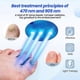 thumbnail image 2 of Nail Fungal Laser Device, Nail Fungus Treatment For Toenai, Laser-device For Finger And Toe Nail Fungus Removal, 2 of 5