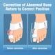 thumbnail image 3 of Férula para Juanete Alisador Del Dedo Del Pie Perilla Correctora Hallux Valgus (negro), 3 of 9