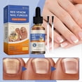 thumbnail image 2 of Bee Venom Nail Serum, Bee Venom Nail Growth & Repair Serum, Bee Venom Nail Treatment Serum, 2 of 5