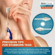 Skin Clinic FREEZE n CLEAR Skin Tag Remover