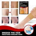 thumbnail image 4 of Parche para aliviar las venas varicosas Dolor en las piernas del muslo Eliminación de arañas Yeso para flebitis, 4 of 6