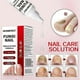 thumbnail image 3 of 1-3x Fungi Nail Treatment Liquid Fast-Acting Nail Repair Strengthening Liquid Nails Care Supplies, 3 of 5