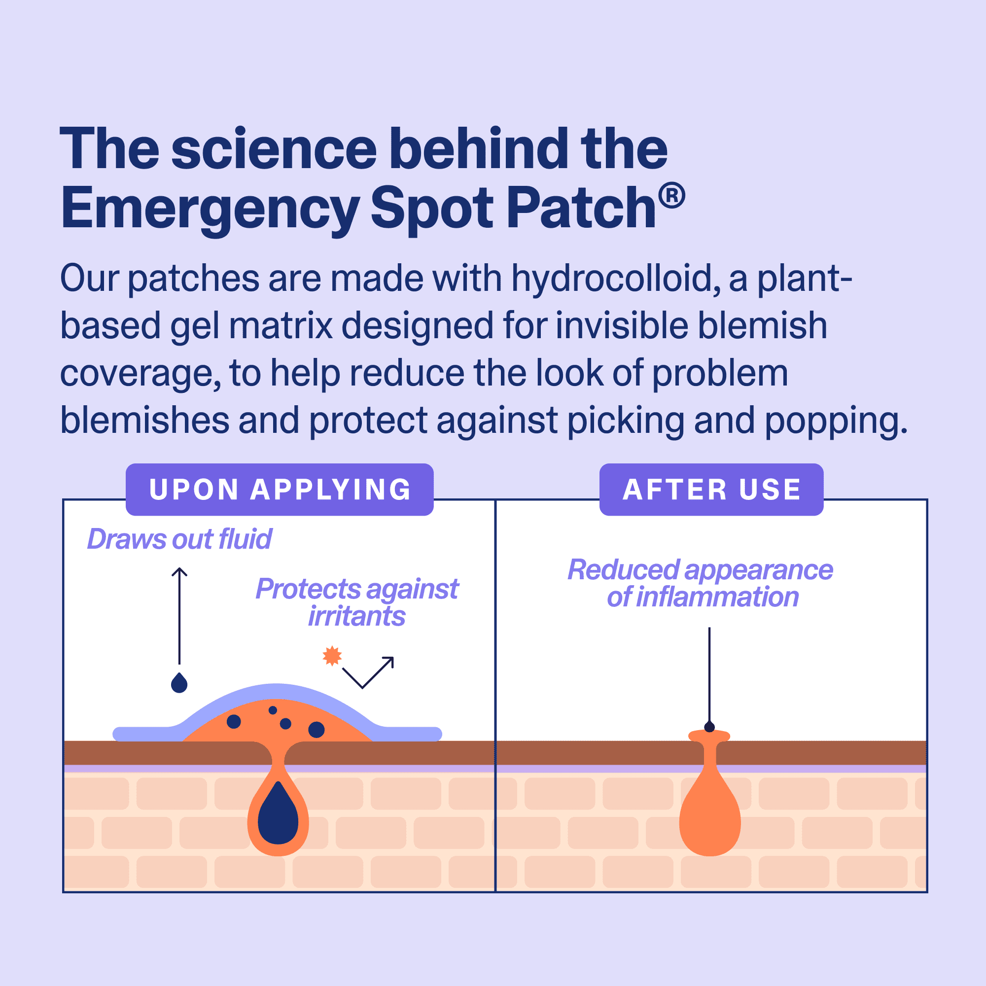 Curology Emergency Spot Patch, Hydrocolloid Pimple Patches for Acne, 40 Count