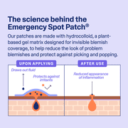 Curology Emergency Spot Patch, Hydrocolloid Pimple Patches for Acne, 40 Count