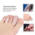 thumbnail image 4 of Qarigey 10 piezas de mangas de tubos de dedo del pie diseño abierto cómodo buena protección mangas de dedo del pie reutilizables Gel diseño Cuidado de los pies, 4 of 6