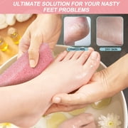 Maryton Pumice Sponge for Feet,Pumice Sponge Stone Exfoliate Foot Feet Care Dead Dry Skin Callus Pedicure Pack of 4