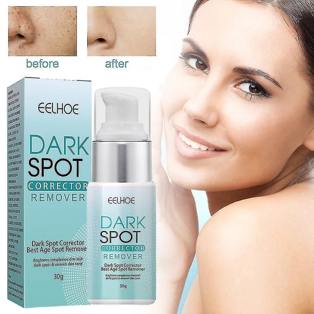 Crema para eliminar manchas oscuras, alivia la cara, el cuerpo, la edad, pigmentación, cuidado de la piel, hidratante Facial antienvejecimiento