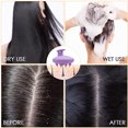 thumbnail image 2 of Cepillo de pelo masajeador de cuero cabelludo de silicona, depurador de cuero cabelludo de ducha con cerdas suaves, masajeador de cabello húmedo y seco Vhermosa, 2 of 5