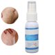 thumbnail image 5 of Veins Spray, Veins Treat Spray Fácil Absorción Alivia La Presión Suaviza La Piel Reduce Las Molestias Para Uso En Exteriores Para Piernas ANGGREK Otros, 5 of 8