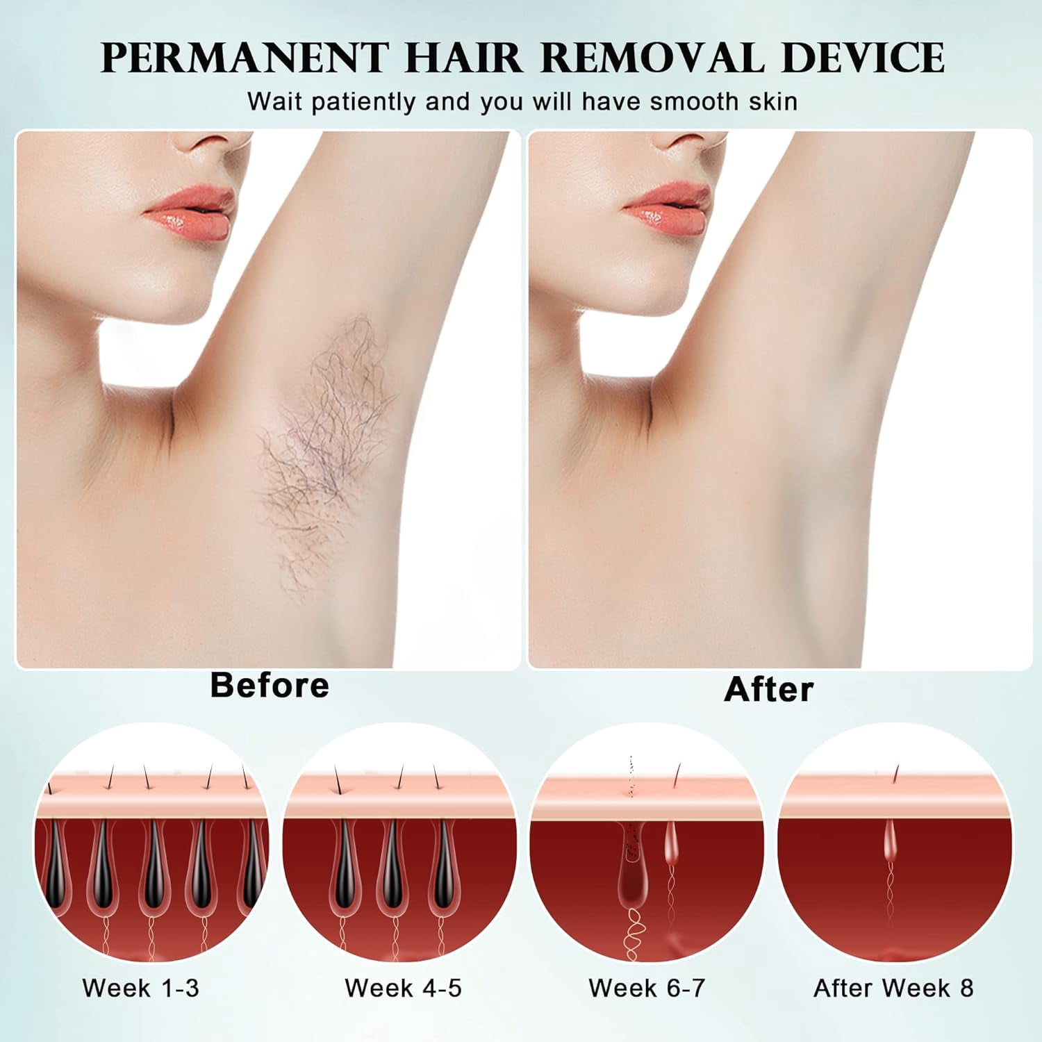 JUUTREN Laser Hair Removal for Women and Men, Painless Laser Hair Removal Device, 999999 Flashes & Dual Lights, At-Home Hair Remover for Facial Legs Arms Bikini Line Whole Body Use