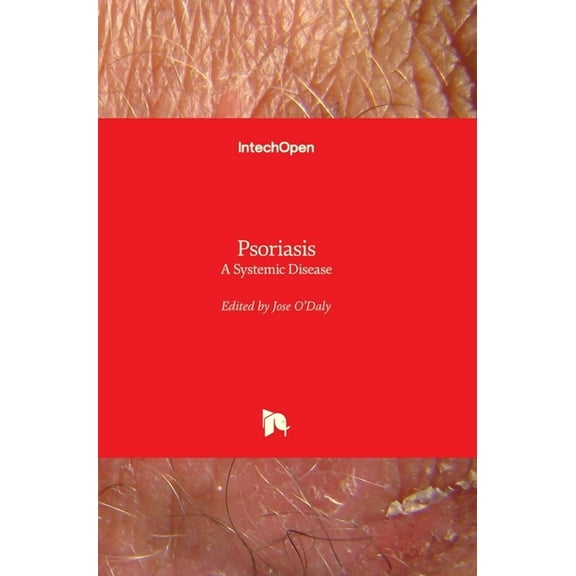Psoriasis : A Systemic Disease (Hardcover)