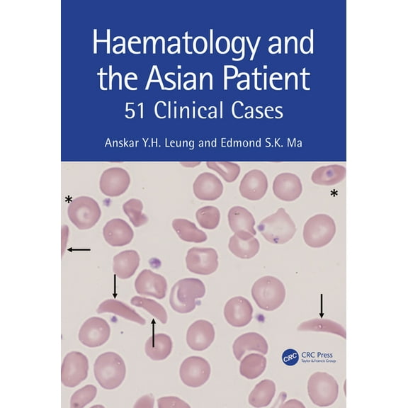 Haematology and the Asian Patient: 51 Clinical Cases, (Paperback)