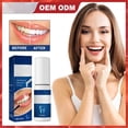 thumbnail image 1 of Pintura dental, restauración dental, limpieza bucal, blanqueamiento, reparación del esmalte, aliento refrescante, blanqueamiento, eliminación de manchas dentales. Agua blanqueadora dental de 5 ml., 1 of 5
