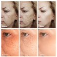 thumbnail image 2 of Crema facial hidratante con Retinol, crema antiarrugas, alivia líneas finas, ojos negros, reafirmante de poros, antienvejecimiento"2 pcs" Fivean LED, 2 of 2
