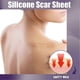 thumbnail image 4 of EELHOE 8Pcs Silicone Scar Sheets Safety Mild Odorless Comfortable Fade Scars Heal Treatment for Old New Scar, 4 of 5