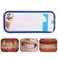 thumbnail image 4 of 20pcs Dental Orthodontic Ceramic Brackets Roth 022 Slot 345 With Hook, 4 of 5