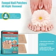 Gotyou Nighttime Renewal Fungal Nail Patches 16 Count Overnight
