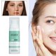 thumbnail image 1 of Crema antiacné, , tratamiento suave para el acné, reducción de , eliminación de espinillas, atención facial, blanqueamiento, inflamación, Yinane Eliminación, 1 of 8
