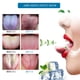 thumbnail image 2 of [Silicona suave] Limpiador de raspador de lengua de 3 piezas, raspador de boca, juego de limpiador avanzado, herramienta de tratamiento de mal aliento, kit eficaz Ormromra HMHZ393, 2 of 7