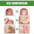 thumbnail image 3 of nail hardening and softening roller 3pcs, 3 of 5