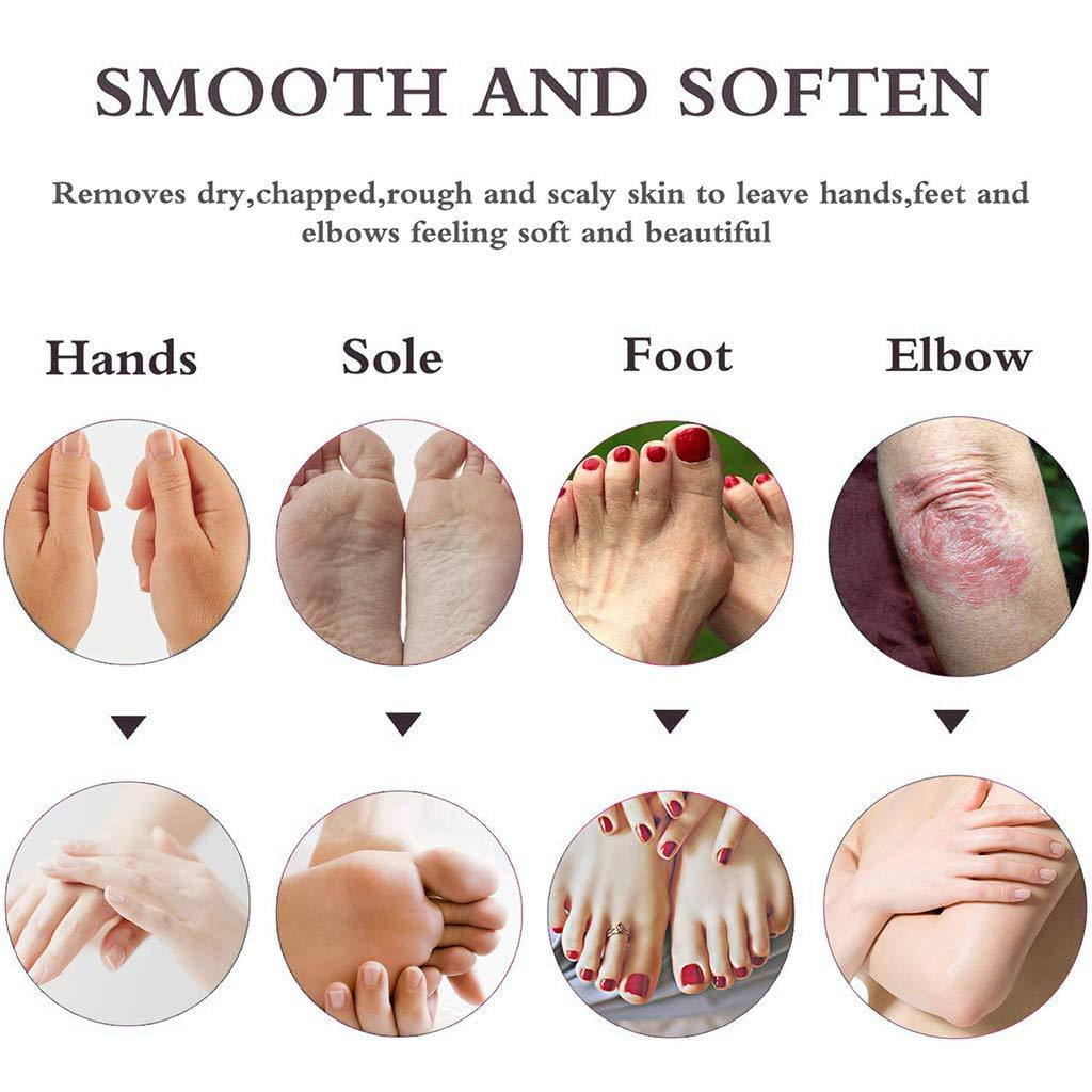 Softsoles Foot Cream For Cracked Heel & Rough(30 gm-Pack of 4)-Feet Cream  For Dry and Cracked Heel Repair With Benefits Of Jojoba Oil,Bees Wax,Wheat  : Amazon.in: Health & Personal Care