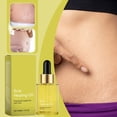 thumbnail image 5 of Skin Oil Tender And Smooth Skin Gentle Moisturizing And Improving Skin Texture 30ml, 5 of 5