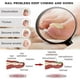 thumbnail image 3 of Ginger Nail Fungus Treatment Extra Strength, Anti Fungal Nail Treatment for Toenails and Fingernails, Toenail Fungal Treatment for Nail Repair, 3 of 5