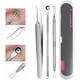 thumbnail image 1 of Herramientas para eliminar puntos negros y acné, 3 piezas, kit de herramientas para quitar espinillas y comedones, extractor de pinzas de acero inoxidable profesional, juego de herramientas plateadas, 1 of 6