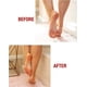 thumbnail image 5 of Pomada curativa para la piel Kerasal Intensive Foot Repair 30 ml, 5 of 9