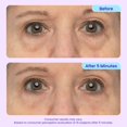 thumbnail image 3 of Gel para ojos goPure Instant Lift antiedad 10 ml, 3 of 7