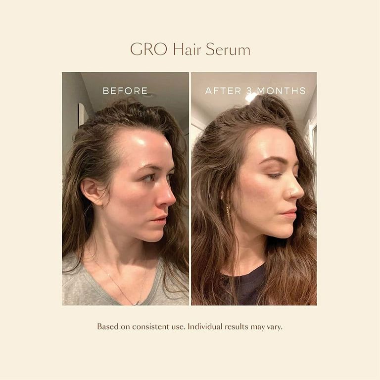 Vegamour hair growth serum discount