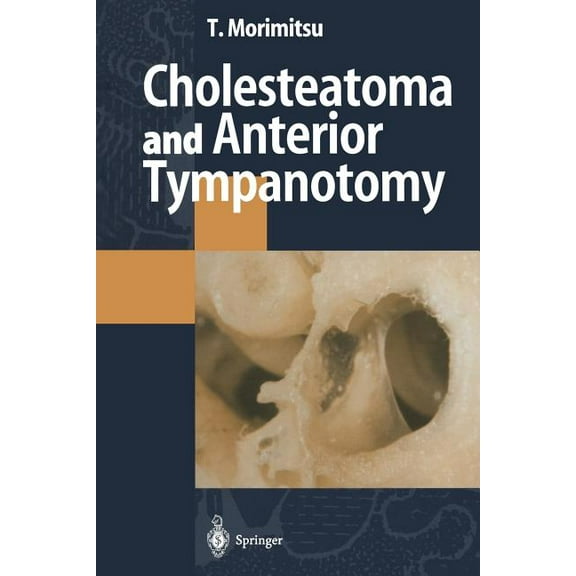 Cholesteatoma and Anterior Tympanotomy, (Paperback)