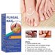 thumbnail image 2 of Nail Repairing Liquid, Speedy and Effective Approach to Toenail Issues - Combating Thick, Discolored Nails - Powerful Solution for Addressing Yellow a, 2 of 4