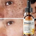 thumbnail image 3 of Suero blanqueador con vitamina C Elimina las pecas Manchas oscuras Esencia facial Atenúa el melasma Melanina Ilumina Repara la piel opaca Cuidado Cosméticos, 3 of 6