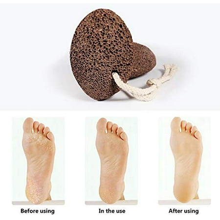 Pumice Stone for feet scrubber - Foot scrubber scrub dead skin removal – Natural Lava pumice stones callus