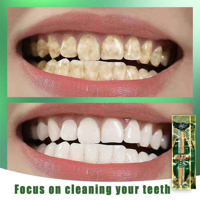 Pack Of 10 Natural Herbal Toothbrush Mewak Siwak Meswak Miswak TOOTH