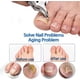 thumbnail image 2 of Black Anti-Slip Grip Gear Lock Nail Clipper Set with Ultra-Sharp Curved Tips for Thick Hard & Ingrown Toenails, Ergonomic Angled Clippers, 2 of 9