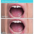 thumbnail image 3 of 2pcs Temporary Tooth Repair Kit For Filling The Missing Broken Tooth And Gaps-moldable Fake Teeth, 3 of 5