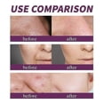 thumbnail image 3 of Niacinamide 20% Serum Anti-Aging Dark Spots Correcting Serum, Nicotinamide Serum 2025, 3 of 5