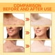 thumbnail image 3 of Jabón Para Aclarar La Piel, Reducción De Imperfecciones Y Acné, Exfoliante, Limpieza De Tono Uniforme, Jabón De ácido Kójico Para Cara, Manos, Cuello, Muslos Internos, Axilas, 3 of 7