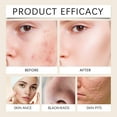 thumbnail image 5 of Good on Ya Face Wash Skin Care Stuff for Girls 10-12 Travel Size Dime Beauty Facial Wash Sensitive Skin Gentle Cleanser: And Pore Refining For All Skin Types Rejuvenating Foaming Cleanser: Nourishing, 5 of 9