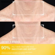 StriVectin TL Advanced Tightening Neck Cream Light 1.7oz