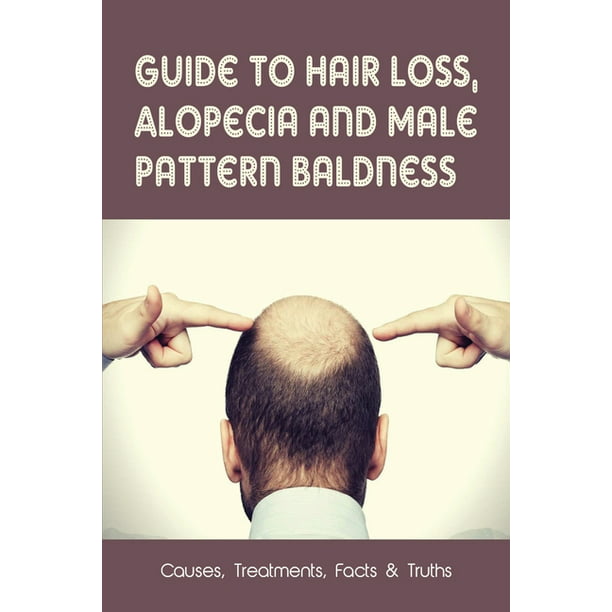 Guide To Hair Loss, Alopecia & Male Pattern Baldness: Causes, Treatments,  Facts & Truths: How To Stop Hair Fall Immediately (Paperback) 