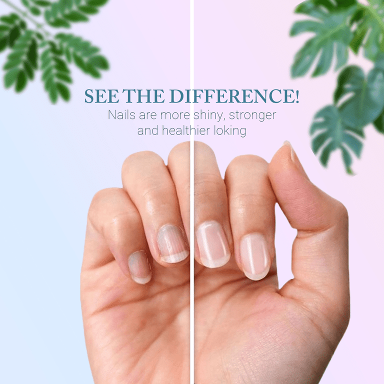 P.Shine Japanese Manicure Nail Kit, Healthy Nails, Pink, Unisex